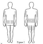 Figure 2 shows you the body sites to chose to inject XEMBIFY.