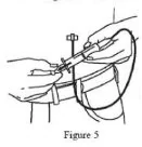 Figure 5 shows you how to determine if you inserted the needle properly.