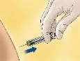 Illus