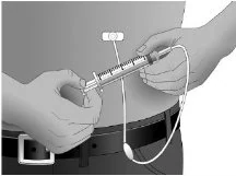 If the needle was not inserted properly, repeat the priming and insertion of the needle